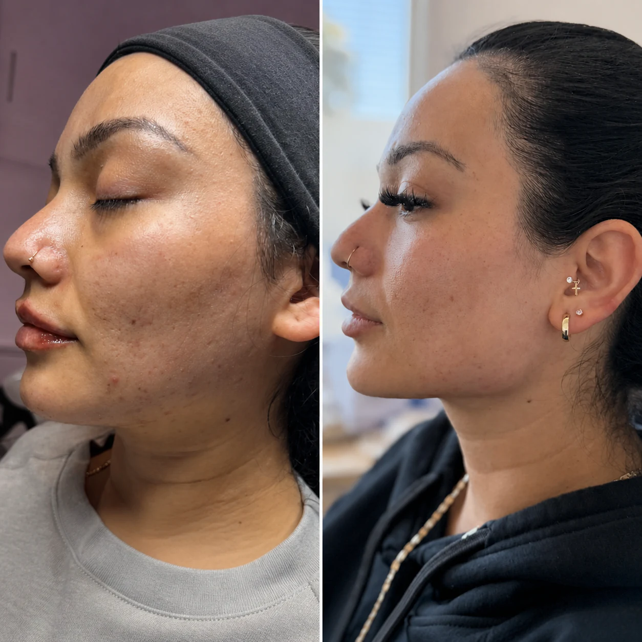 Before and after client result, example one