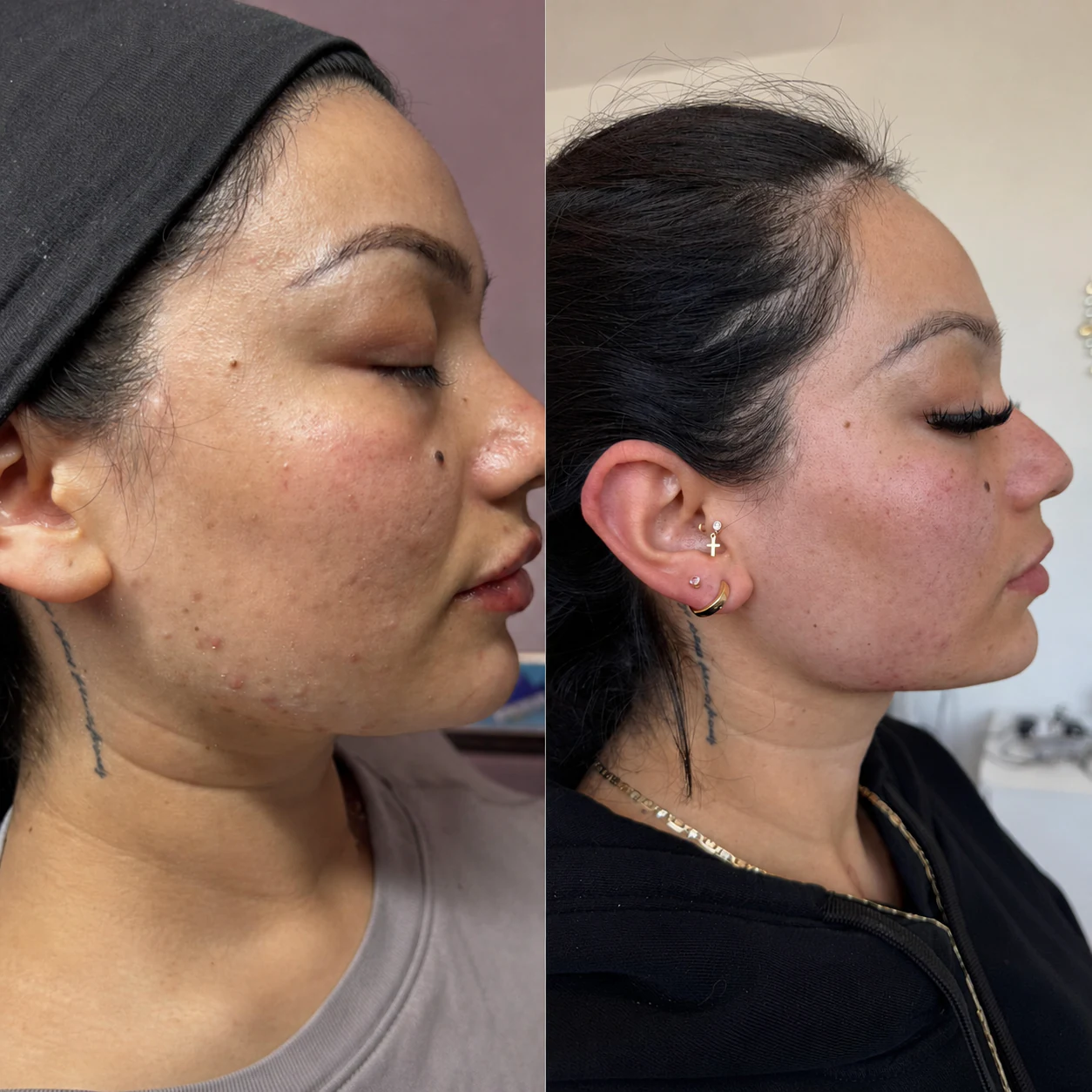 Before and after client result, example two