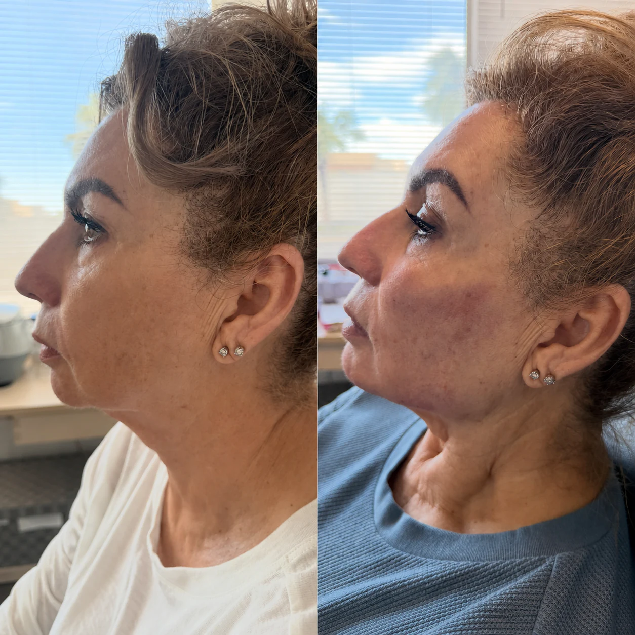 Before and after client result, example three