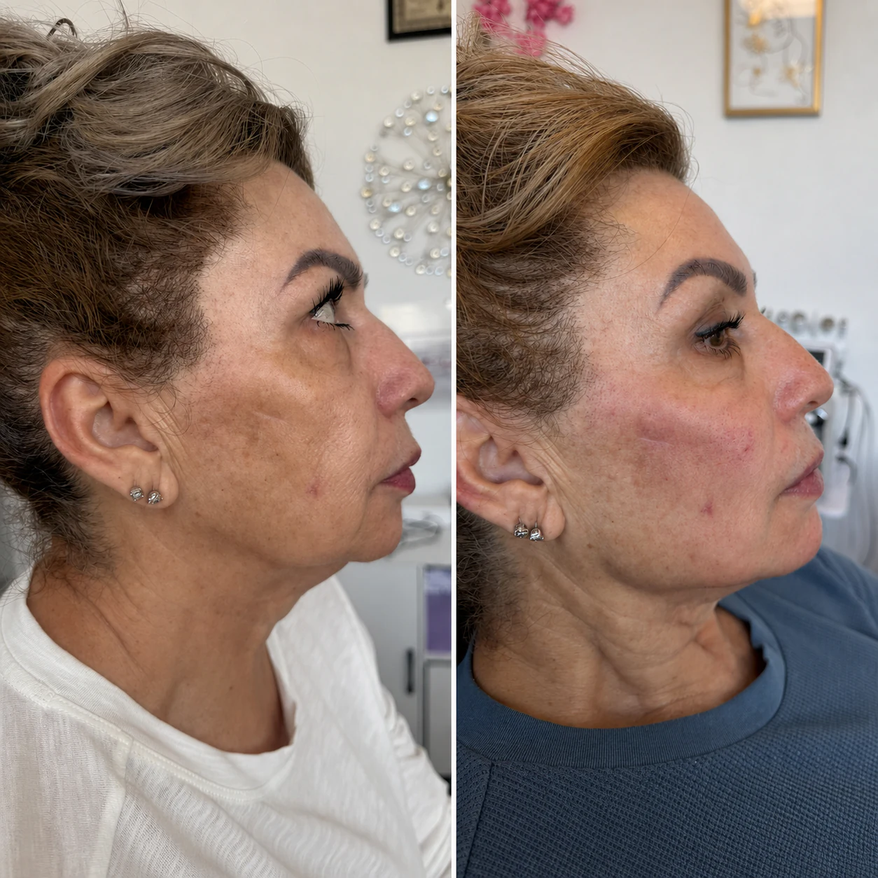 Before and after client result, example four